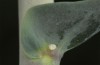 Calophasia opalina: Egg (N-Greece, Siatista, May 2014) [N]